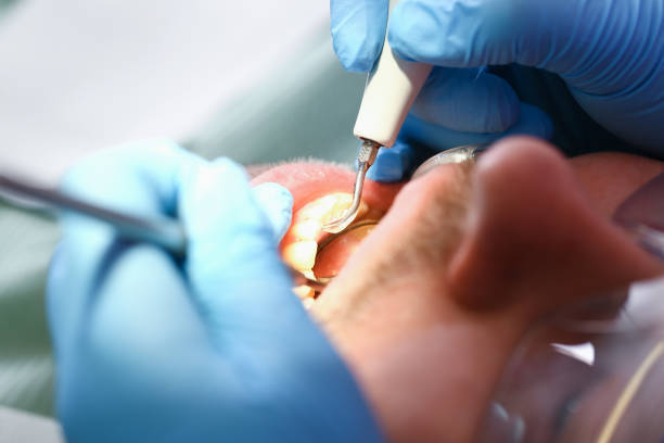 Best Emergency Treatment for Toothache in Eggertsville, NY