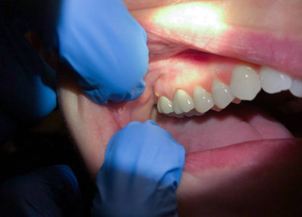 Best Emergency Dental Surgery in Eggertsville, NY